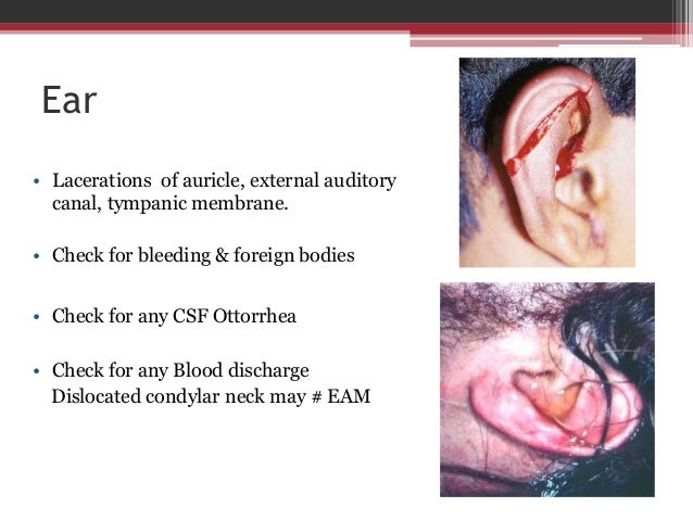 evaluate facial trauma Toy cumshot movies